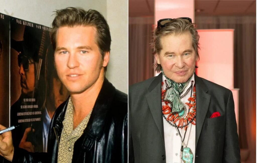 De acuerdo al reporte médico, Val Kilmer falleció debido a la complicación de un cuadro de neumonía.